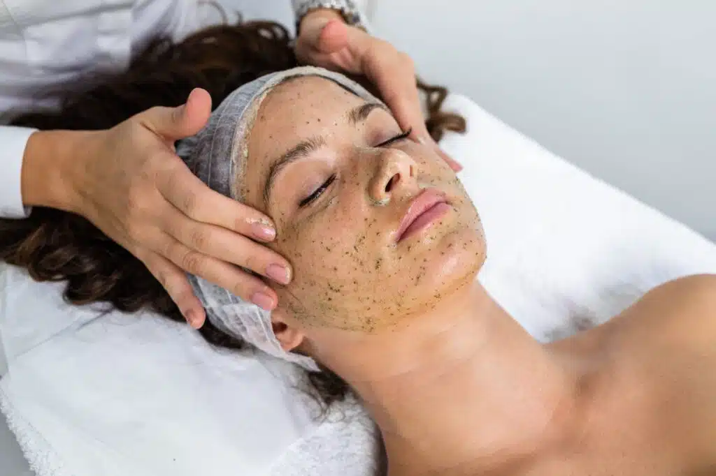 green-peel-behandling